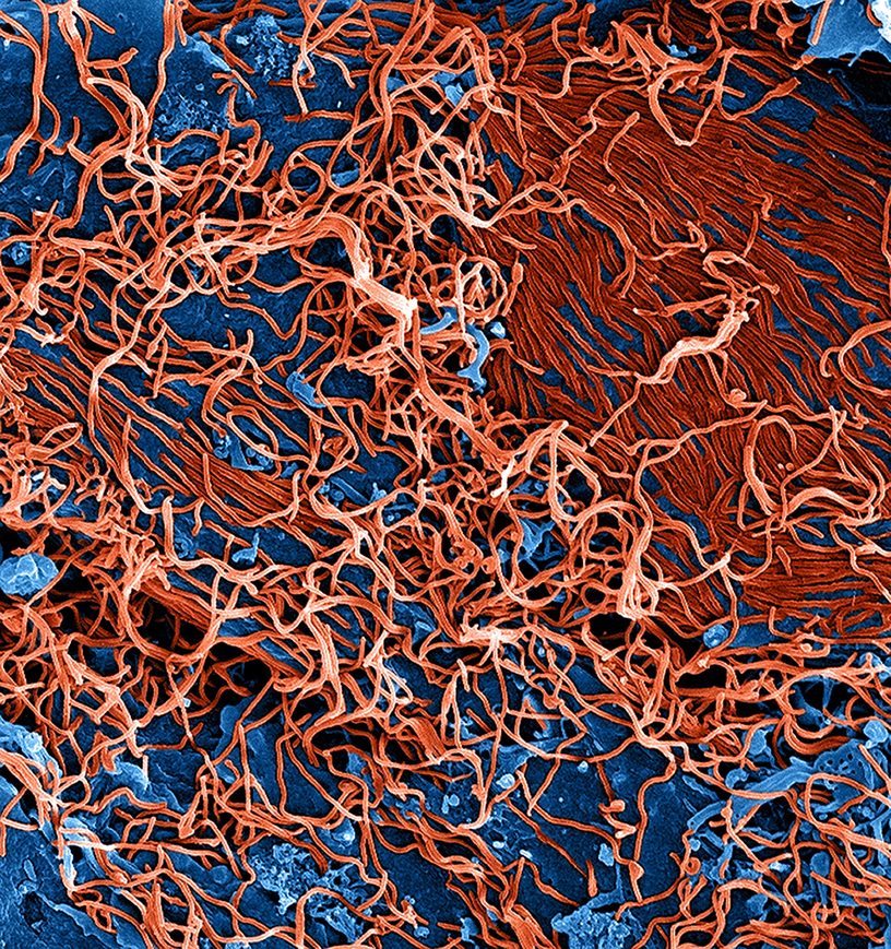 Partículas del virus del ébola (en rojo) adheridas a una célula infectada, vistas con un microscopio electrónico de barrido y coloreadas